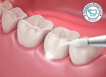 Advanced Painless Laser Dentistry