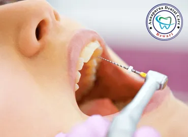 Root Canals Microscopic RCT Treatment