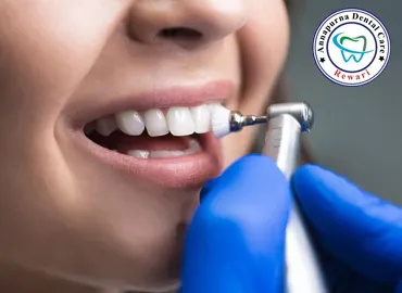 Professional Teeth Cleaning and Ultrasonic Scaling